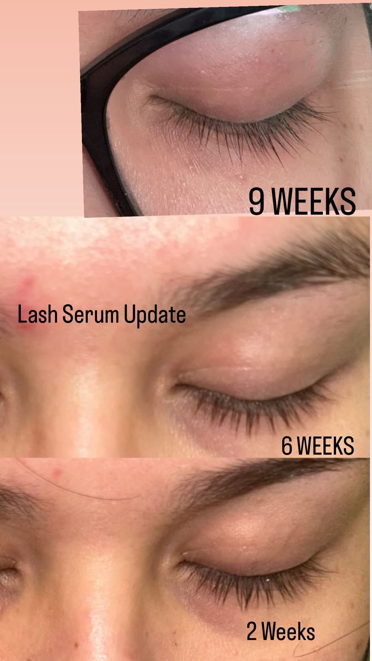 Eyelash growing Serum